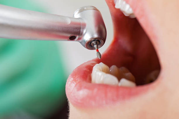 Best Knocked-Out Tooth Emergency  in Carolina Forest, SC